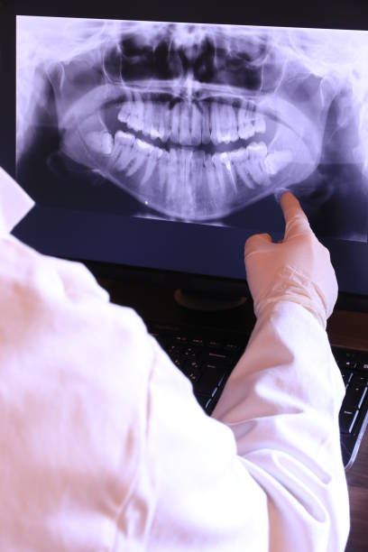 Best Emergency Wisdom Tooth Extraction in Vinton, IA